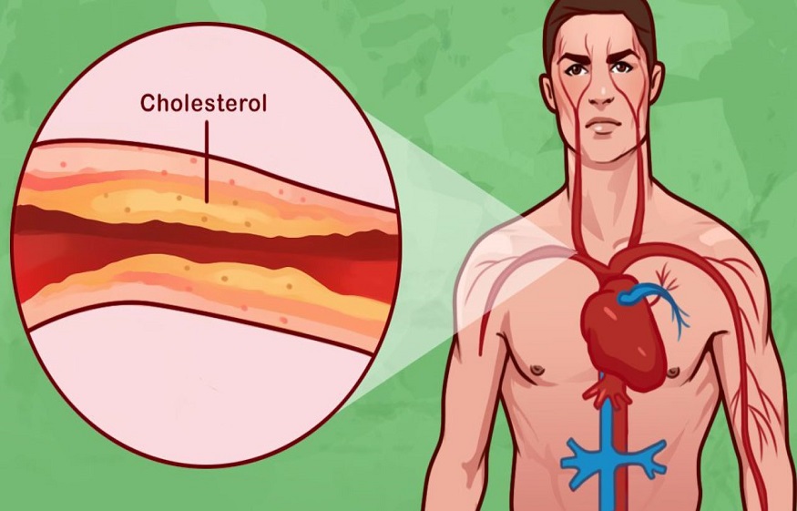 Cholesterol In The Human Body